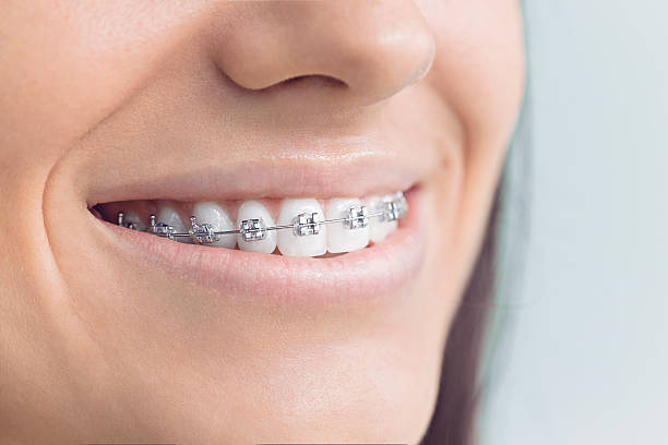Best Full Mouth Reconstruction  in York, NE